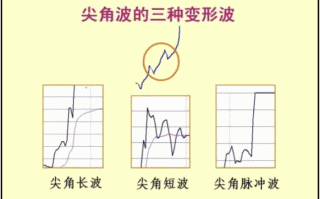 股票盘口分时语言之三大分时走势类型 2：尖角波（图解）