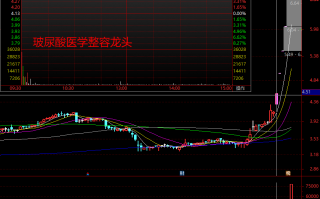 龙头战法是“第几板”买股票？（图解）