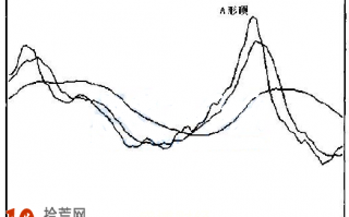 图解5日均线A形顶形态卖出法